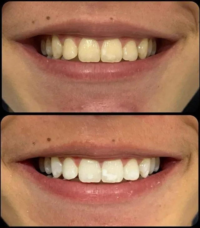 Antes e depois, caso real 4